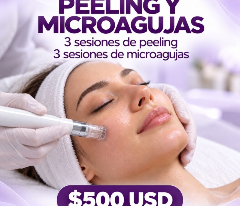 Peeling y Microagujas