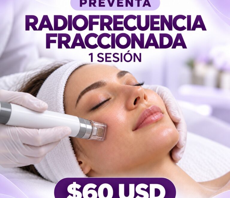 Radiofrecuencia Fraccionada